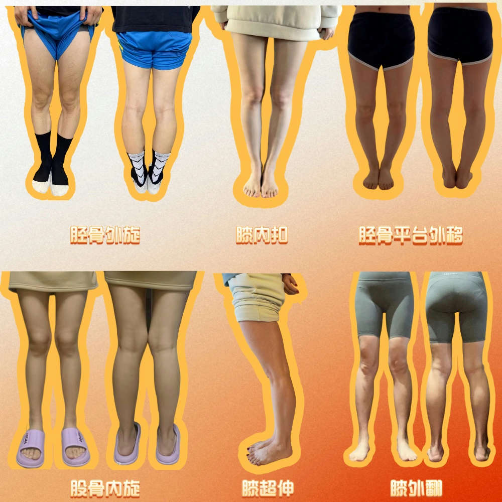 腿型科学纠正 — 直腿训练（不含答疑）