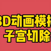3D视频演示：子宫切除如何进行？对身体有什么影响