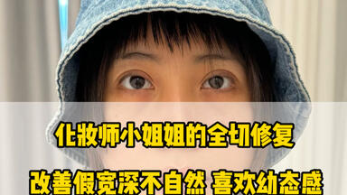 <em class="keyword">双眼皮修复</em>全程大曝光～宽降窄、去肉条、深改浅、无神改灵动！