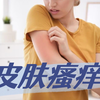 “痒痒痒！抓抓抓！”——反反复复，不仅仅是湿疹那么简单