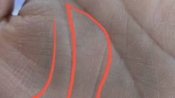 元宝纹是一种罕见的手