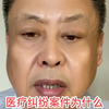 医疗事故纠纷官司有张静律师