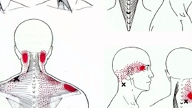 如何拉伸肩胛提肌 04a0175e404a869264c3518cf7ab57eded2bcd01.jpg@280w_158h_1c_100q.jpg