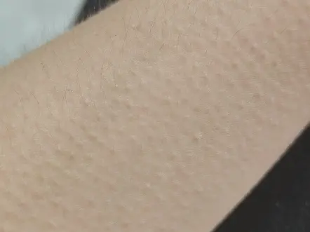 你们身边有没有能自主控制鸡皮疙瘩