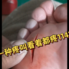 有一种疼叫看着都疼1142期