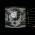 7.盆腔MRI解剖图谱-男性盆腔淋巴结MRI解剖