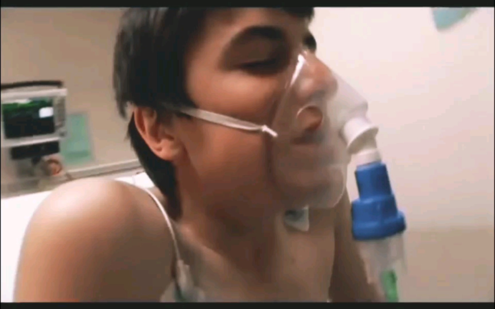 欧美-少年哮喘