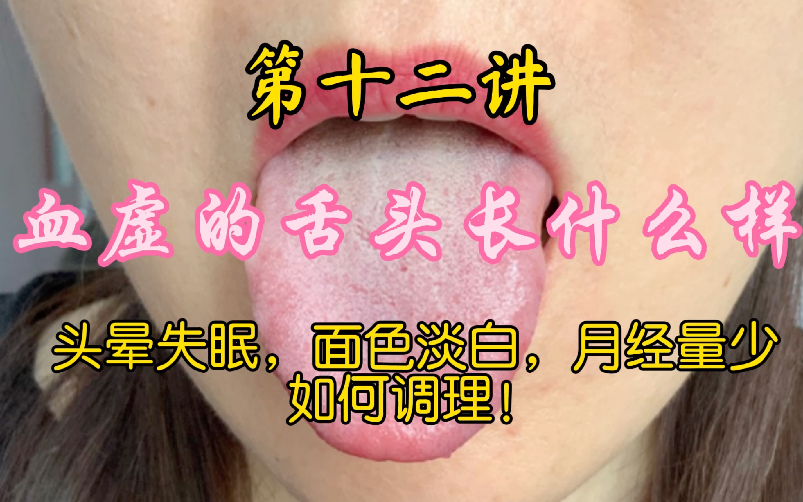 为什么人的舌头有长短之分？一般正常来说多长的舌头算比较正常？ - 知乎