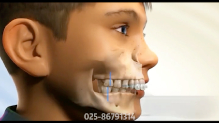 牙齿矫正前后，变化能有多明显？