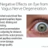 ！！！你的视力或许还有救：由迷走神经和颈椎(C1C2）不稳定带来的眼睛问题（黑点/灰点/视力下降/模糊/散光）