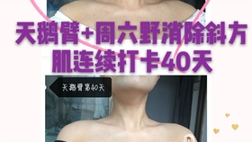 0bc70bde4637be59b059afd8b270172a107fc24d.jpg@280w_158h_1c_100q.jpg