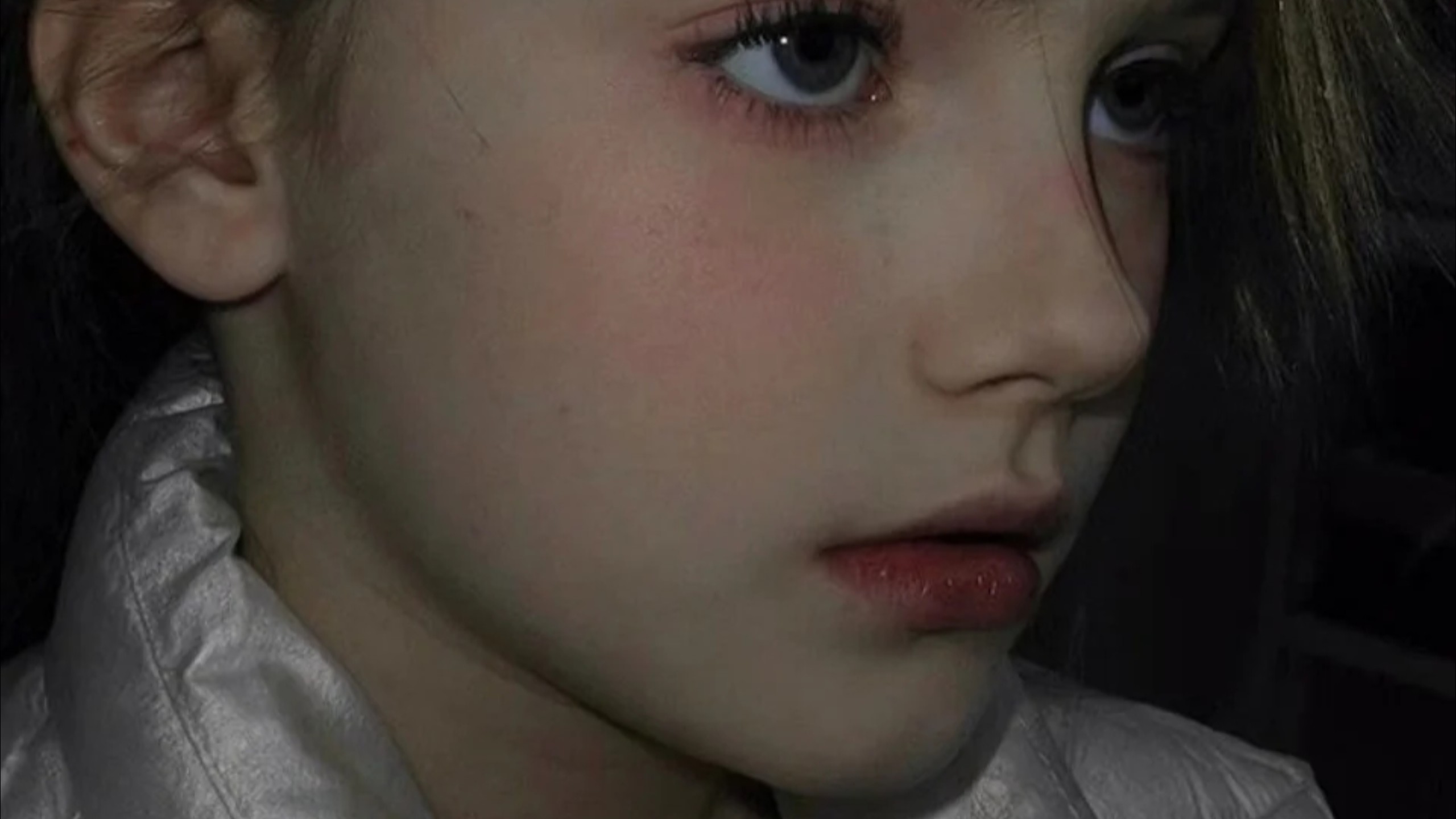 『上镜礼盒』面中、颌面抬升丨鼻小柱发育丨颧骨后退