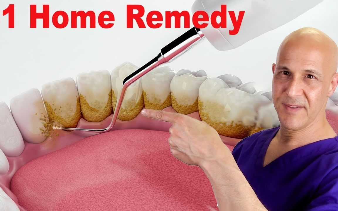 在家就可以有效清洁牙垢的方法分享【Mandell博士】