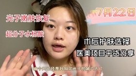 0c9cba178f5b55aad96bbced44bd2a8d2319216d.jpg@280w_158h_1c_100q.jpg