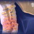脊柱骨折后为什么会瘫痪，3D演示。。