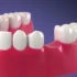 关于牙齿那些事：牙科各种基本操作示范！