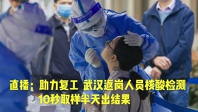 哪里可以做核酸检测武汉 0e1eabb8312829d25ccfe2d15afc356e8ee5f186.jpg@280w_158h_1c_100q.jpg