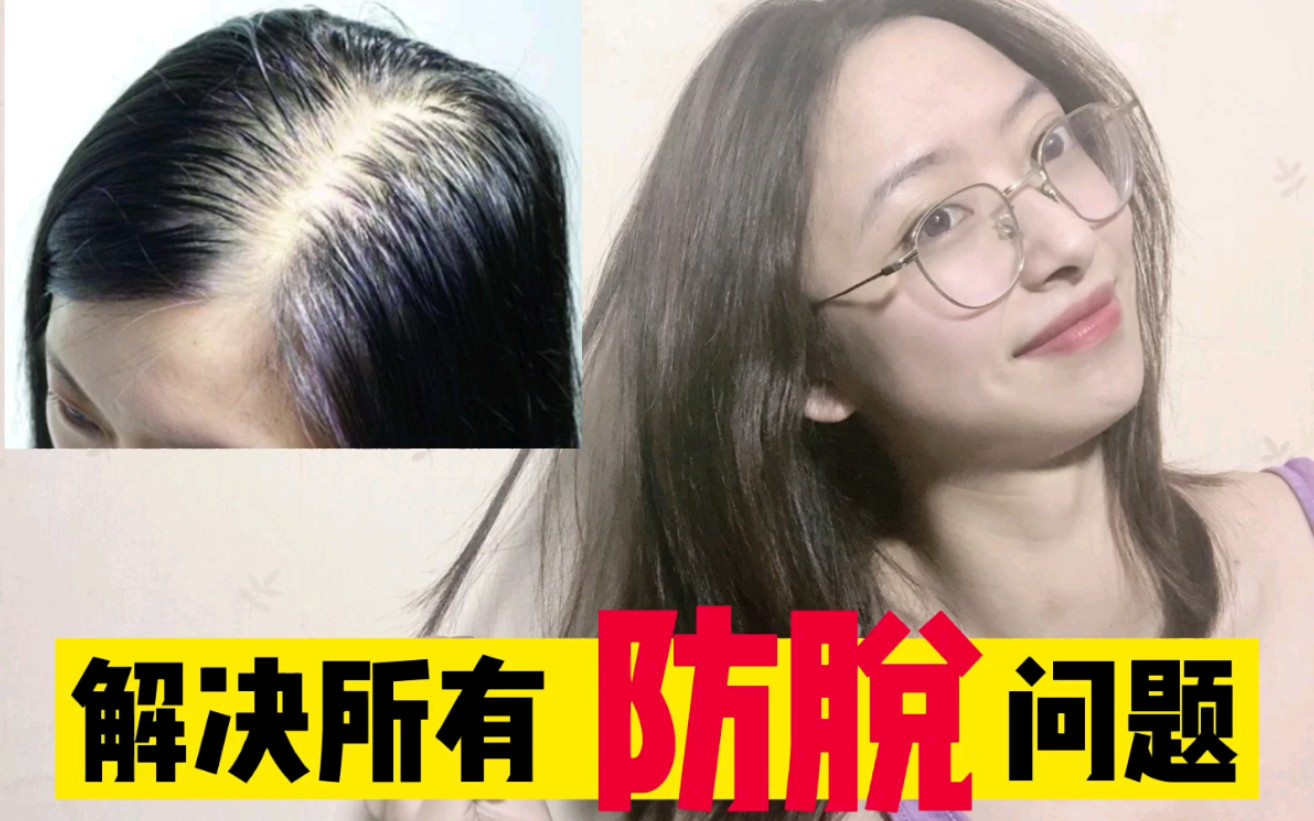 【内调食疗防脱发】地表最强治疗脱发攻略，蓬松头皮，控油头皮