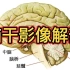 影像基础：脑干影像解剖分享，放射科医生讲解！