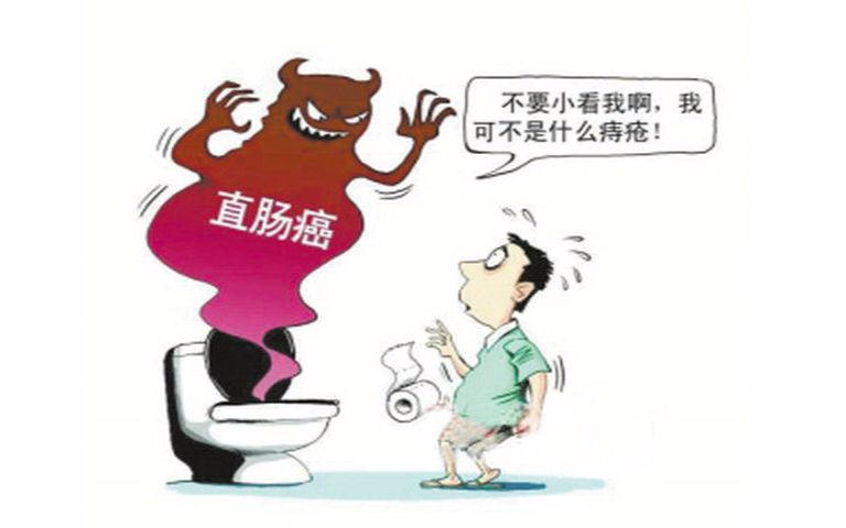 得了直肠癌有什么表现?该如何预防?