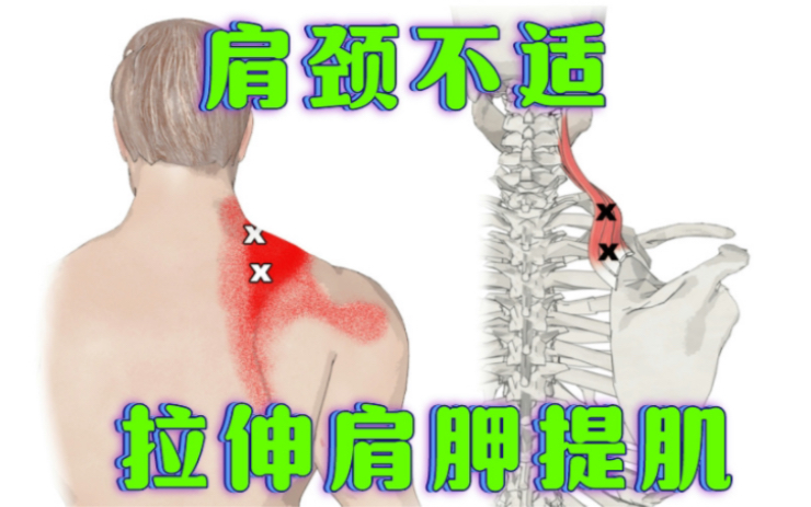 肩颈不适可能是肩胛提肌紧张，拉伸放松可以有效缓解