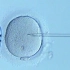 第二代“试管婴儿”：卵胞浆内单精子显微注射技术，一个新生命就这样开始了...