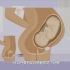 你听说过子宫脱落吗？是什么导致了盆腔脏器脱垂的发生？