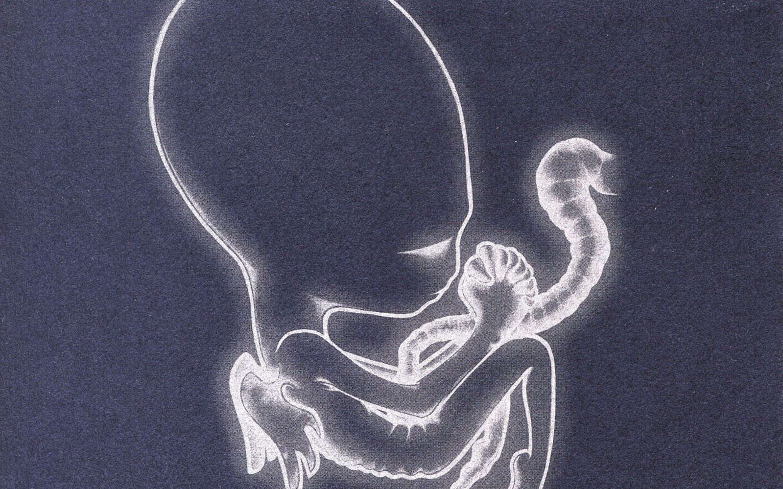 【冰岛/后摇】sigur ros - starálfur