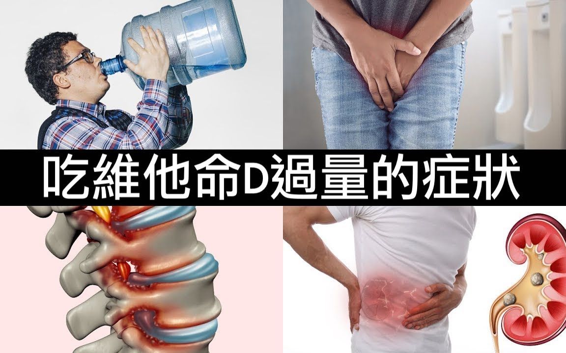 吃維生素Ｄ過量的第一症狀？ 柏格醫生 Dr Berg