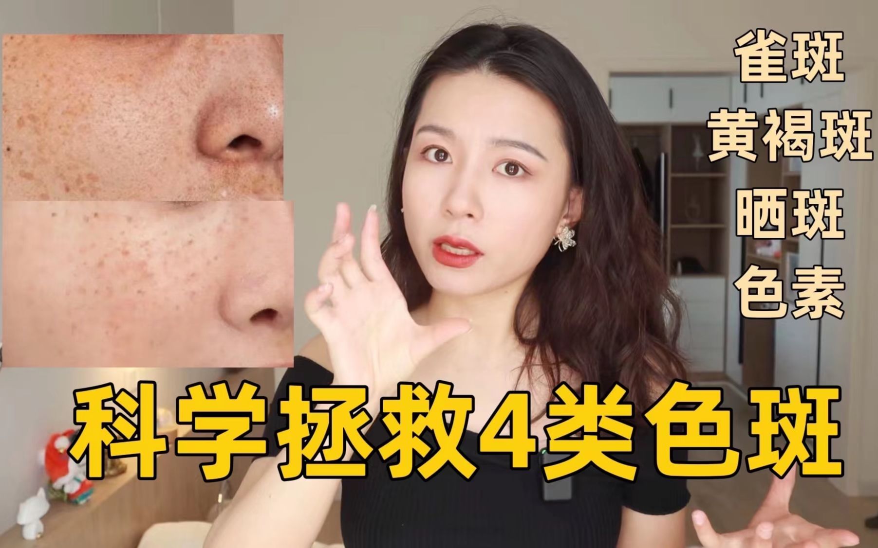 淡斑看这一个视频就够了！