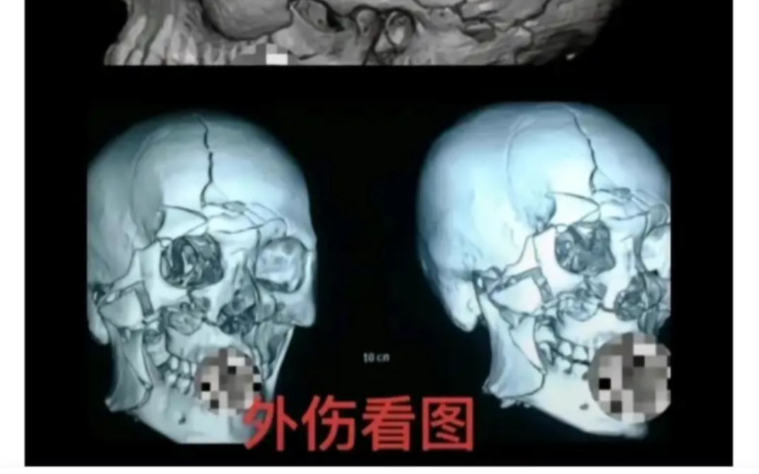 去给哈吉米做治疗，结果自己变成了植物人（无良宠物医院）