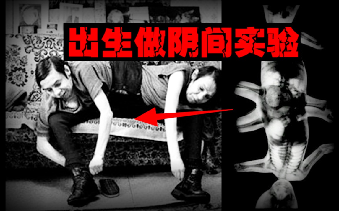 【阴间实验】用连体双胞胎做各种实验，相爱相杀的一生