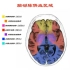 『血管』脑的供血区域.mp4