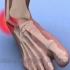 康复知识：踝关节扭伤动画（梅奥诊所）