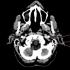 3.头颈CT解剖图谱-感觉器官CT解剖