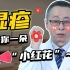 【杨希川教授】史 上 最 全 湿 疹 日 常 护 理 攻 略