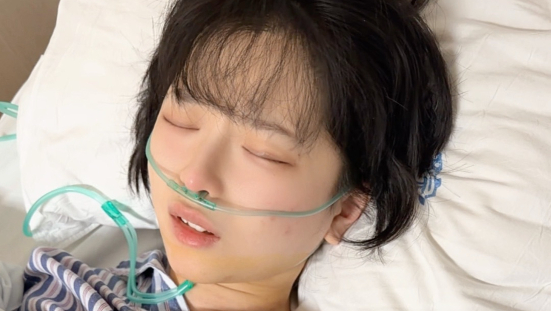 全麻手术