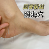 回答粉丝：照海穴   （仅代表个人观点