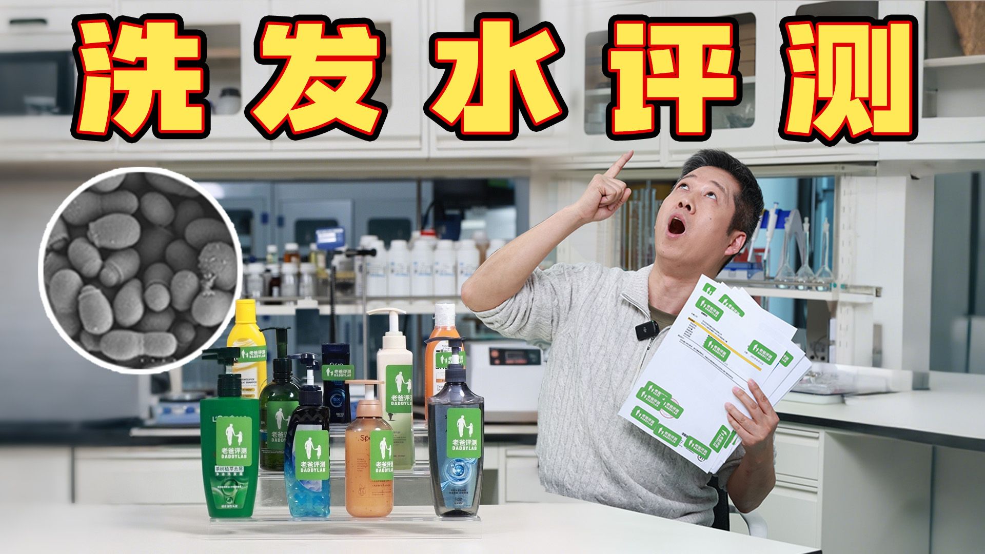 头屑总是洗不掉？可能是洗发水选错了!