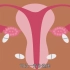 多囊卵巢综合征伤害女人有多深？快看看你是否中招！