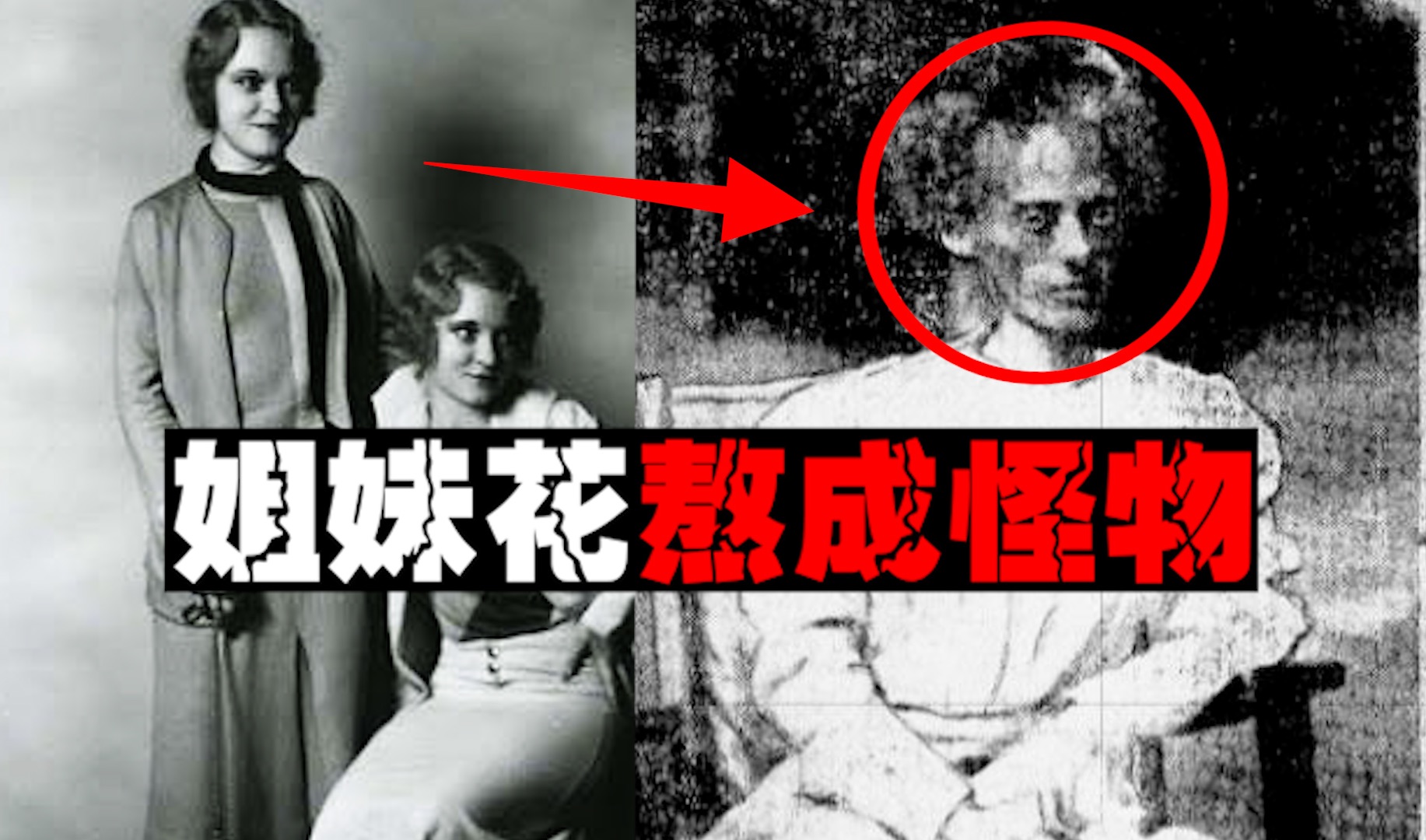 【邪饿疗法】把人饿成20公斤需要多久？庸医饿死几十人再饿死自己