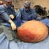 女子身上长了一个127斤的巨型肿瘤，切下来都花了整整1天！@油兔不二字幕组