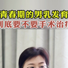 青春期男乳发育，要不要做手术治疗