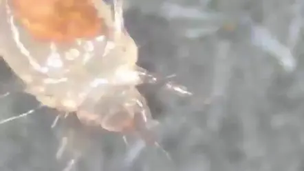 阴虱的生命周期是多久时间 #阴虱 #虱子 #虱子卵