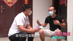 烧伤药膏大公开 1b5369acb78d186b853ab09bdba3dabe68a070ff.jpg@280w_158h_1c_100q.jpg
