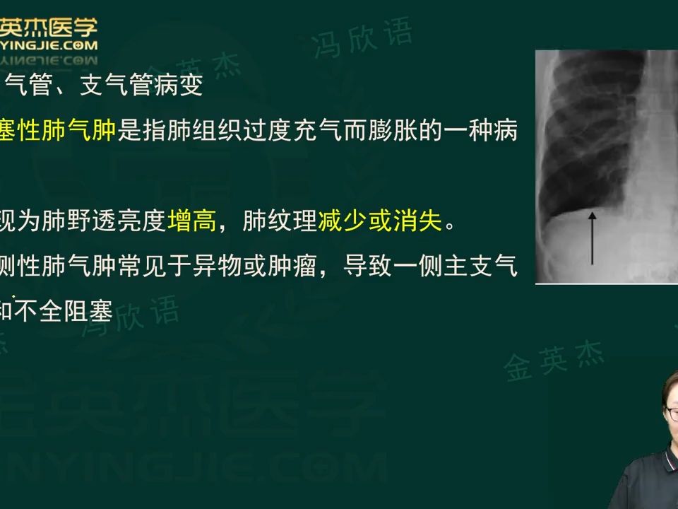 2025年放射医学技士、师、中级考试第2篇 相关专业知识-第6章（2）