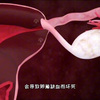 女性生殖器官的构造，3D演示