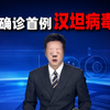 均与涉疫邮轮有关！法国确诊首例汉坦感染病例，美国乘客一人阳性一人出现症状