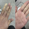 女子晒冬天手脚冰凉照，医学生喊话快去医院“这是病”！网友炸锅