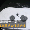 男子下班后爱闻自己的臭袜子 致肺部真菌感染